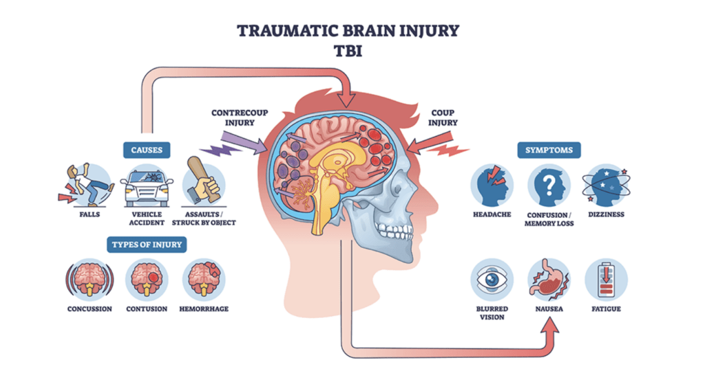 Infographic showing causes, types, and symptoms of traumatic brain injury